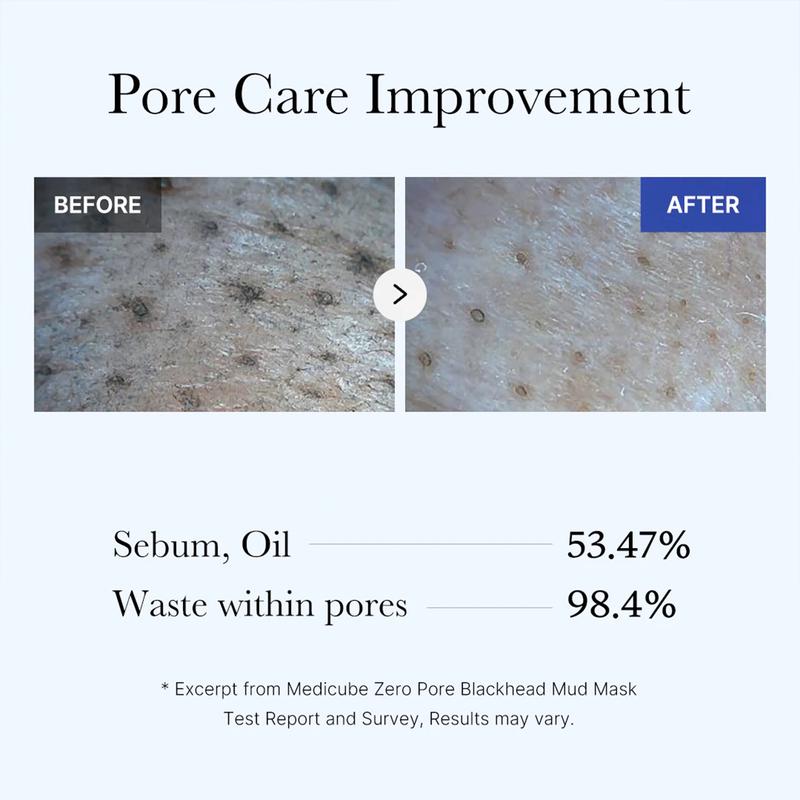 Zero Pore Blackhead Mud Mask | 3 min mud mask