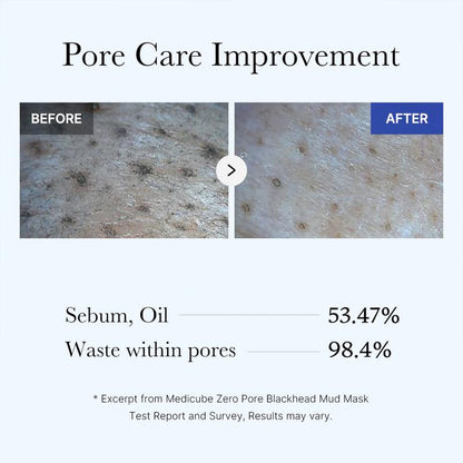 Zero Pore Blackhead Mud Mask | 3 min mud mask